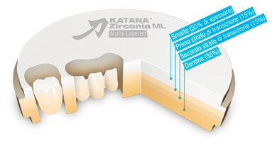 KATANA Zirconia ML (Multi-Layered) Disc, la prima zirconia policromatica al mondo