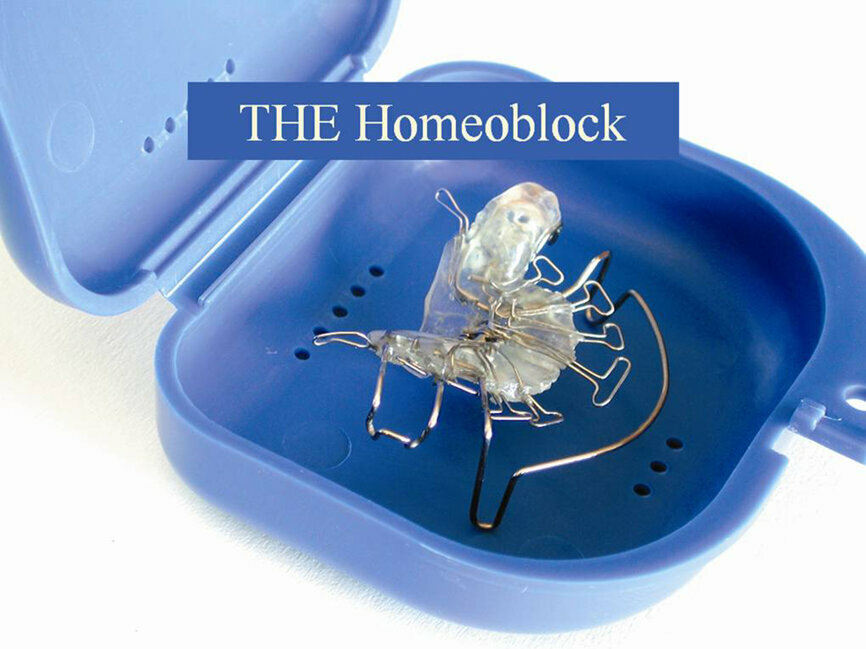 Fig. 2 The Homeoblock appliance.
