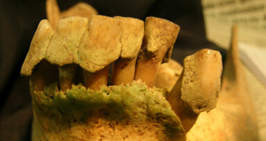 Researchers examine ancient diets using dental plaque