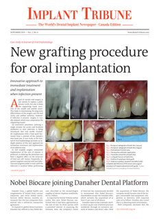 Implant Tribune Canada No. 4, 2014