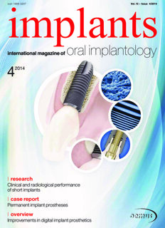 implants international No. 4, 2014