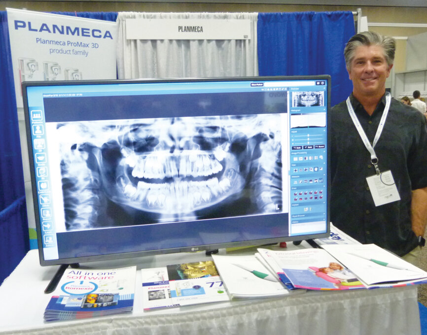 Ask Glen Kendrick of Planmeca about its All-in-One Software.