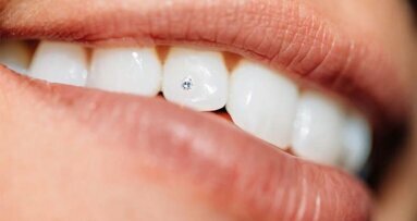 The Cosmo-Dentist Makes Smiles Sparkle With Tooth Jewel