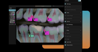 AI & ML for real time pathology detection in dentistry