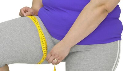 Verband gevonden tussen obesitas, geslacht en parodontale gezondheid