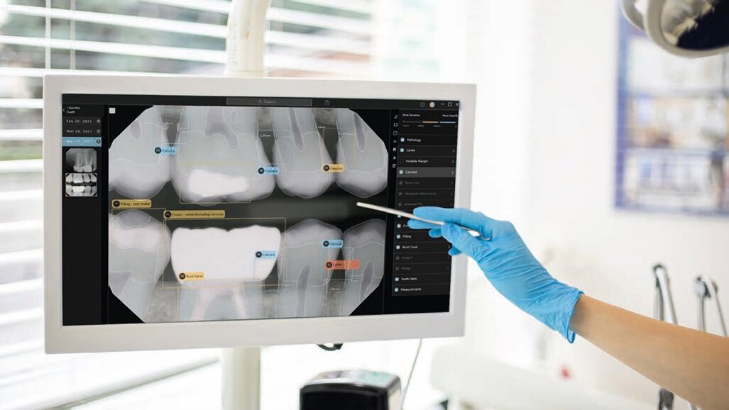 La revolución de la IA en la Odontología