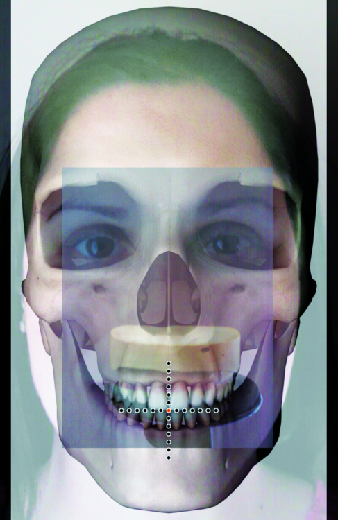 Fig. 11: Screenshot skull-face-cast
