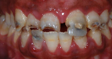 Estética dental y comunicación con el paciente