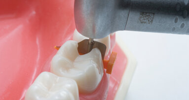 Fenderwedge protects the adjacent teeth