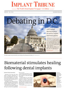 Implant Tribune U.S. No. 6, 2012