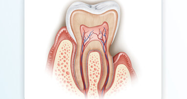 Managing dentine hypersensitivity