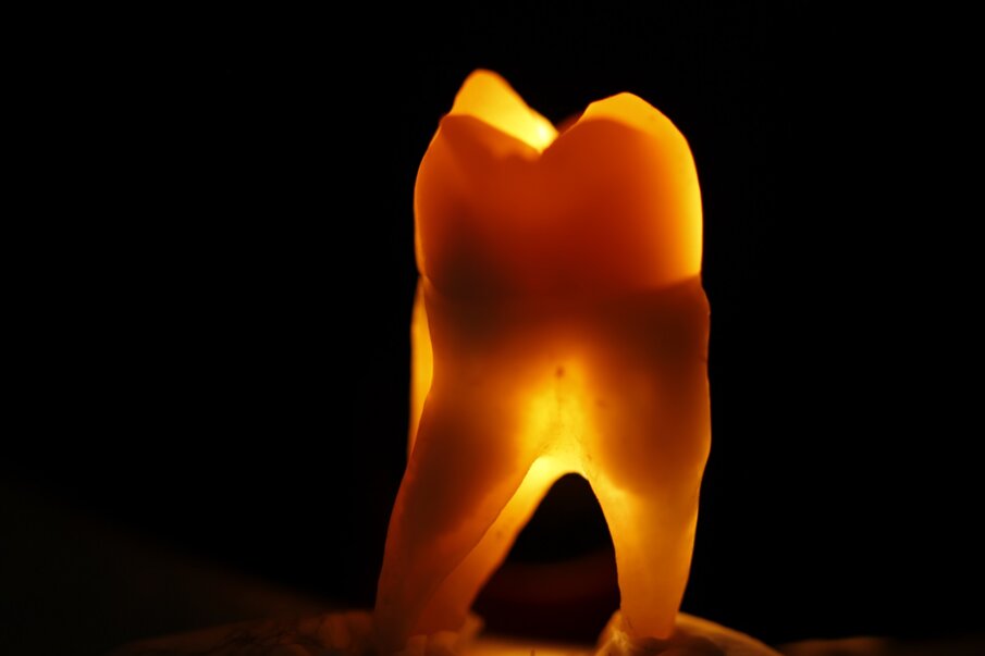Fig. 12b: Light dynamics of natural teeth in direct and indirect light.