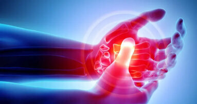 Periodontal disease more common in patients with rheumatoid arthritis