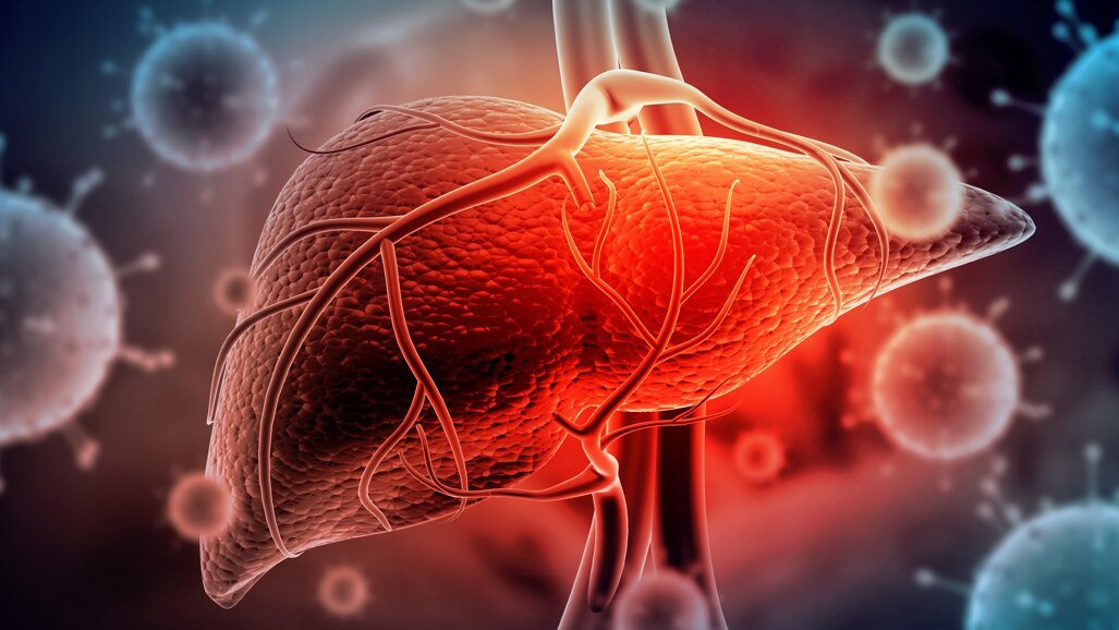 New clinical study confirms link between liver inflammation and periodontitis