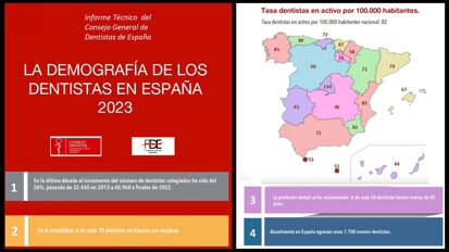 Significativo aumento del número de dentistas en España