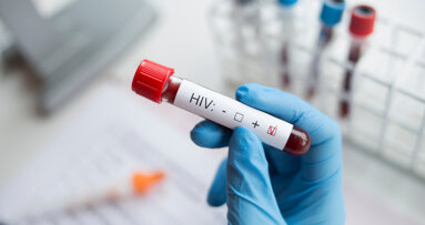 People living with HIV struggle to access oral health services