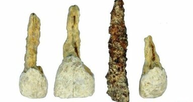 Oudste tandprothese in West-Europa ontdekt