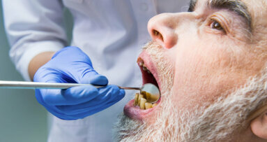 Schlechte Mundhygiene beschleunigt schwere COVID-19 Verläufe