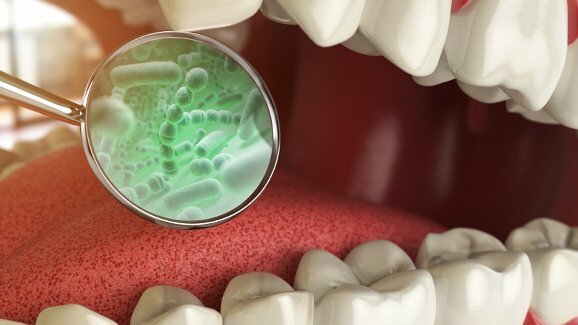 Nowe badania skierowane na bakterie chorobotwórcze jamy ustnej