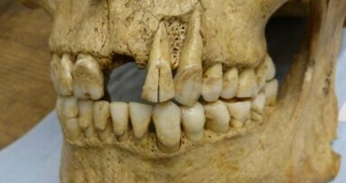Research uses dental plaque to uncover potential for insights into ancient diets