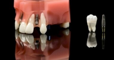 Cercetarile pe reptile dezvaluie secretele implanturilor dentare