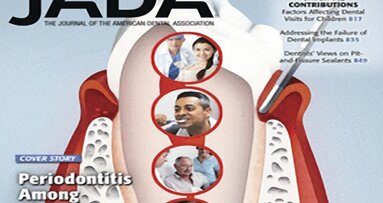 Prevalencia de periodontitis en hispanos en EE UU