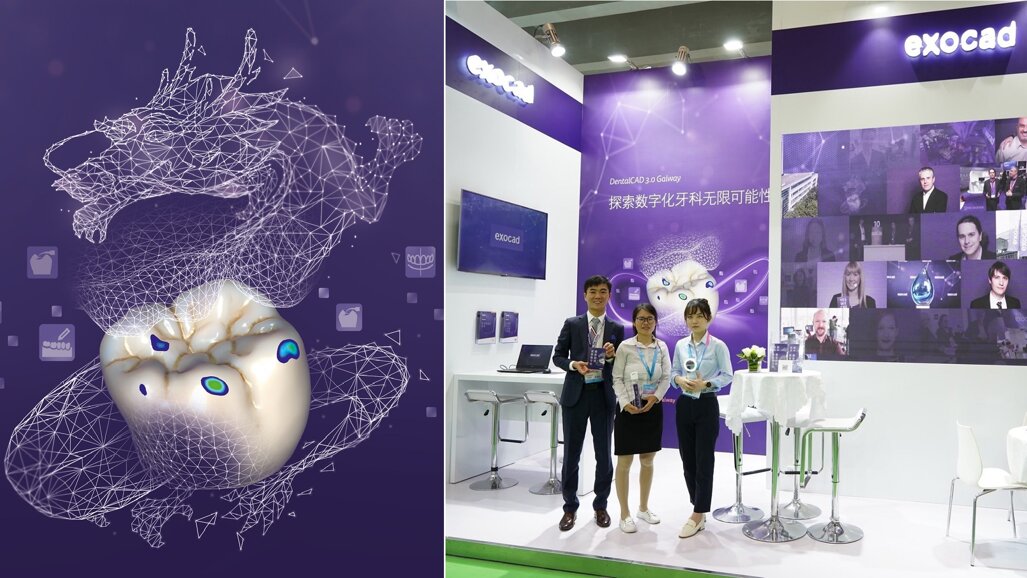 Exocad to showcase latest software solutions at Dental South China show