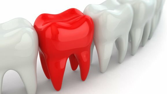Why dentistry needs branding
