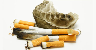 Tobacco harm reduction core element of periodontal therapy, says head doctor