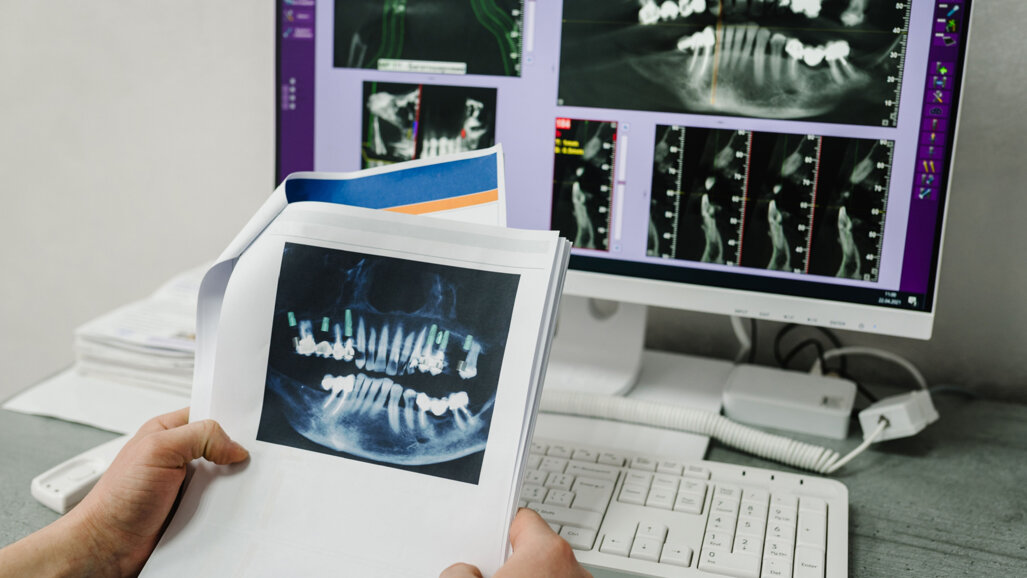 Big data could mean better outcomes for implantology