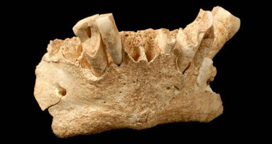 Une plaque dentaire révèle les habitudes alimentaires des premières espèces humaines