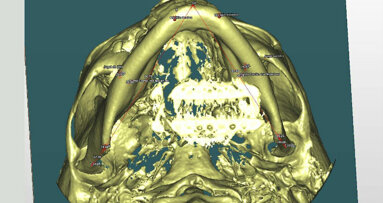Asimmetria scheletrica: analisi 3D per diagnosi precise