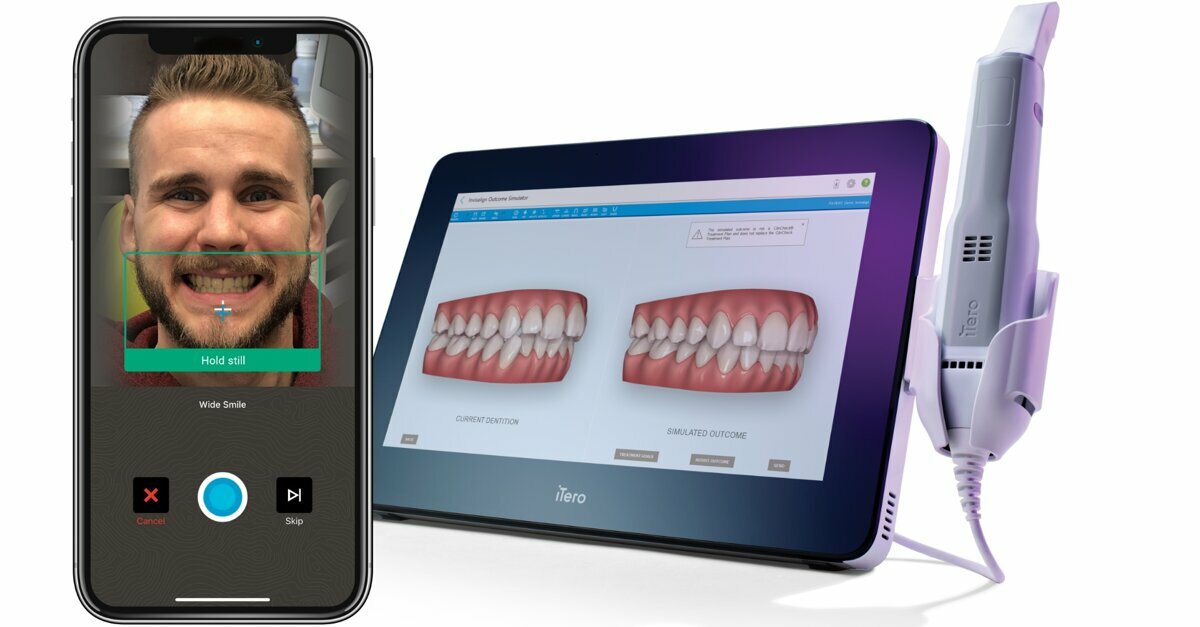 Align Technology Brazil - We're the company behind the smile 