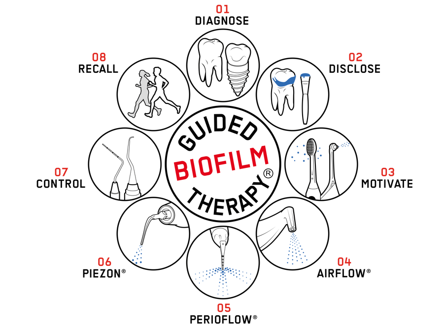 Fig. 2: The 8 steps of the Guided Biofilm Therapy compass