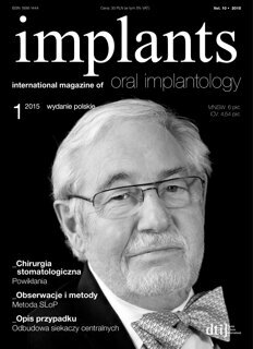 implants Poland No. 1, 2015