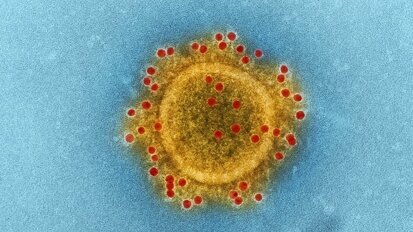 “El coronavirus nos ha mostrado nuestra vulnerabilidad”