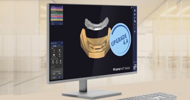 Ceramill 4.4: más eficiente y más indicaciones 