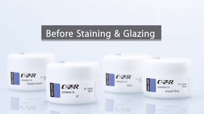 CZR FC Paste Stain - Before Staining & Glazing