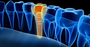 EAO Junior Committee presents guidelines for development of implant dentistry in the next decade