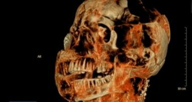 סריקות CT חדשניות מגלות כי לקורבנות של פומפיי היו שיניים מעולות