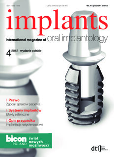 implants Poland No. 4, 2012