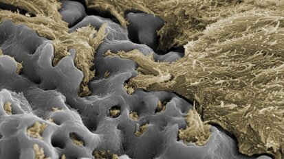 Review confirms clinical success of Nobel Biocare’s TiUnite surface