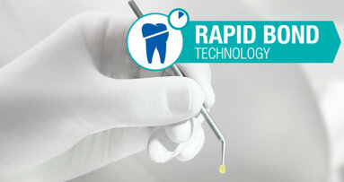 How rapid bond technology changes universal dental bonding agents