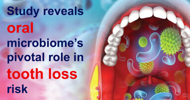 Study reveals oral microbiome’s pivotal role in tooth loss risk