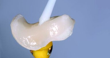 Silane coupling agents and surface conditioning in dentistry