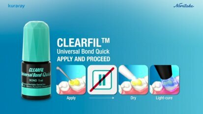 CLEARFIL Universal Bond Quick Commercial