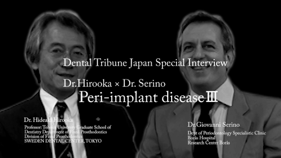 弘岡秀明氏 ＆ ジョバンニ セリーノ氏 対談インタビュー －Peri-implant disease Ⅲ－