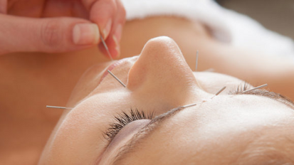 Akupunktura može pozitivno da doprinese stomatološkom lečenju
