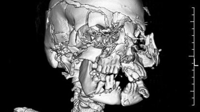Forensic odontology—Broader than just identification