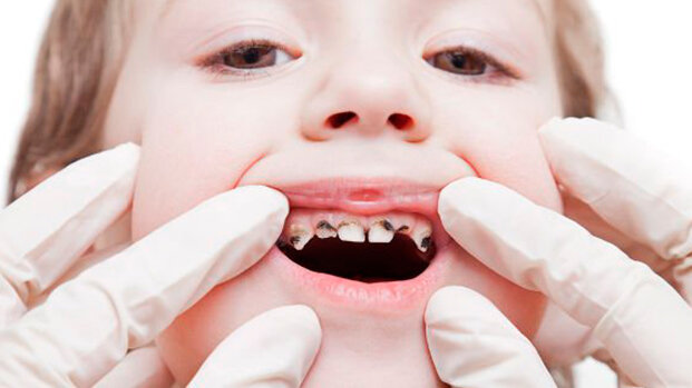 Australia, sotto la lente il sistema di cure odontoiatriche gratuite per bambini
